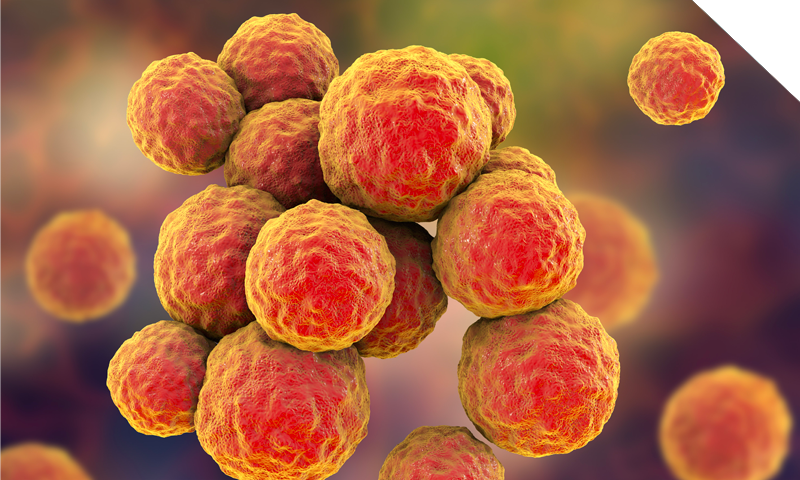 rule out a suspected MRSA outbreak